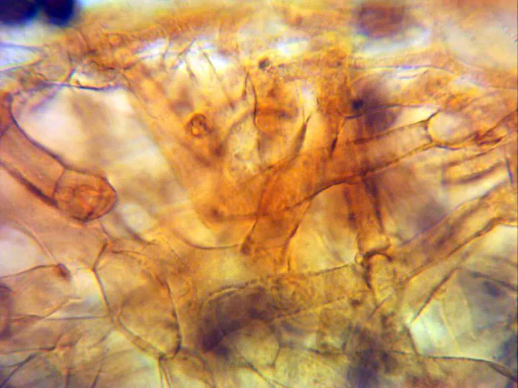 Microscopía de Deconica coprophila - 3 - Sección cutícula